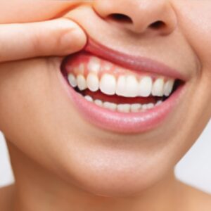 Caring for Your Gums